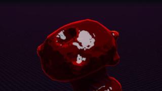 Shatterspleen
